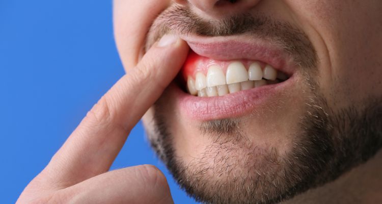Common Dental Problems and How to Prevent Them